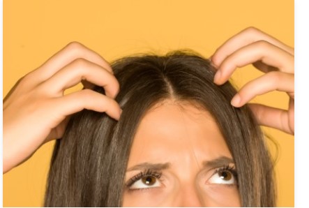 فروة الرأس المتهيجة